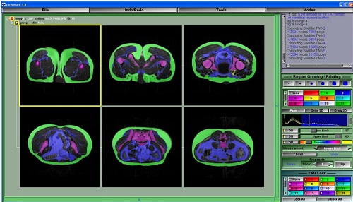 Tomovision sliceOmaticV5.0.9