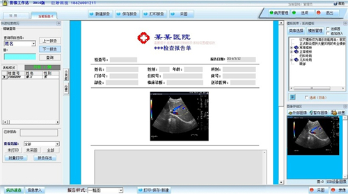 四维彩超工作站v1.0