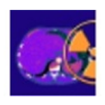 Sante CT Viewerv2.2
