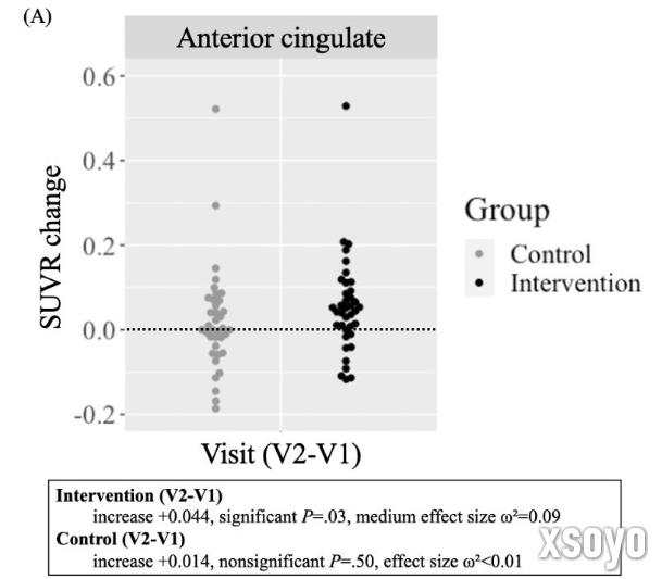国外新研究 游玩10周大脑训练类游戏可抵消10年脑退化